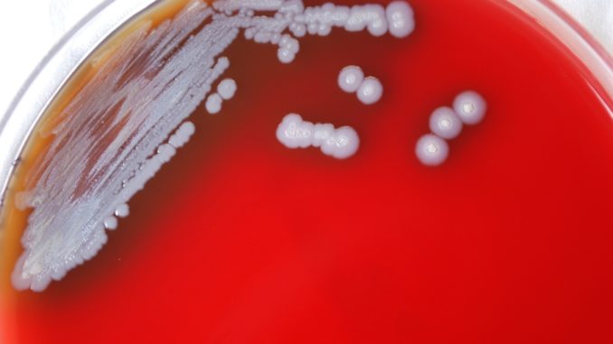 Bacteria that causes rare tropical disease found in US soil